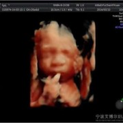 四维彩超看不到宝宝的手指和脚趾有什么事吗,胎儿手指发育过程