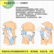 胎儿胎位不正怎么办（36周，胎位不正怎么办）