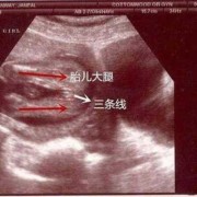 两个月婴儿腿能并拢吗,胎儿并着腿可以看出男女吗