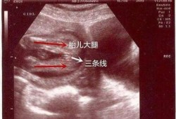 两个月婴儿腿能并拢吗,胎儿并着腿可以看出男女吗