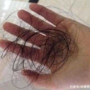 孕期掉头发严重怎么办（孕期掉头发是什么原因造成的）