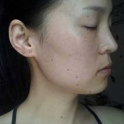 孕期怎样预防长斑（孕期怎样预防长斑长痣）