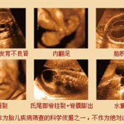 胎儿上唇图（胎儿上唇是什么意思）
