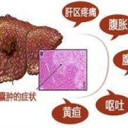 肝囊肿是怎么形成的,胎儿囊肿是什么原因引起的