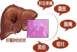 肝囊肿是怎么形成的,胎儿囊肿是什么原因引起的