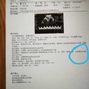 胎儿右肾双肾盂（27周的胎儿产检发现只有一个肾可以生吗）