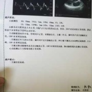 孕妇查胎儿心脏彩超价格是多少,胎儿心脏彩超必须要做吗