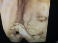 胎儿四维彩超图片（卸货的宝妈都来说说宝宝生下来和四维彩超照片像不像）