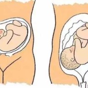 胎儿老打嗝,孕晚期胎儿老是打嗝正常吗