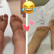 买鞋子要比脚长大多少呢,孕期脚长大了,生了小孩会恢复吗