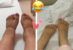 买鞋子要比脚长大多少呢,孕期脚长大了,生了小孩会恢复吗