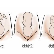 胎儿暂头位（胎儿暂头位是什么意思）