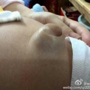 胎儿拱肚脐（胎儿拱肚脐眼怎么回事）