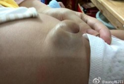 胎儿拱肚脐（胎儿拱肚脐眼怎么回事）