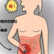 孕期阑尾（孕妇阑尾炎保守治疗）