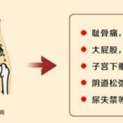 孕25周，翻身时总感觉耻骨疼是怎么回事,孕期耻骨分离的症状有哪些