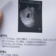 什么是孕囊？孕囊的作用是什么,胎儿胚囊大小对照表