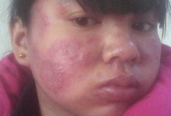 孕妇身上发痒是什么原因,孕期脸部痒怎么回事
