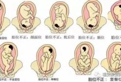 胎儿头位于耻上（23周头先露是什么意思）
