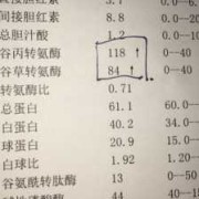 孕期转氨酶（孕期转氨酶高的原因）