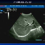 胎儿什么门（胎儿什么门?）