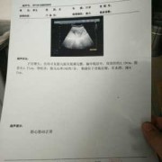 孕期做了10多次彩超（孕期做了10多次彩超对胎儿有影响吗）