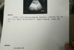 孕期做了10多次彩超（孕期做了10多次彩超对胎儿有影响吗）