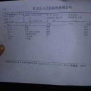 孕期白带检查