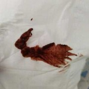 怀孕期间小便有血迹（孕39周，小便完后，用纸巾擦拭有血丝是什么原因啊？血不多）
