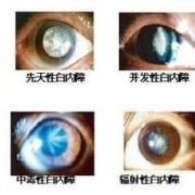 胎儿晶状体（托玛琳对孕妇有辐射吗）