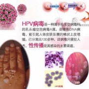 尖锐湿庞影响胎儿吗（尖锐湿庞对胎儿的影响）