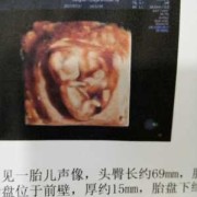 13周胎儿多大（怀孕13周胎儿多大）
