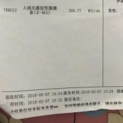 请问，孕妇怀孕时血液中可以检测出胎儿DNA,胎儿鉴别验血报告