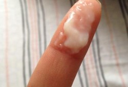 孕期白带像水（孕期白带像水一样稀的是怎么了？快六个月了，会有危害吗）