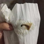 孕期白带红