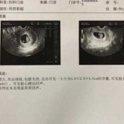 怀孕10周胎芽应该多大,胎芽多少cm变成胎儿