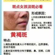 孕期怎样预防长斑（孕期怎样预防长斑长痣）