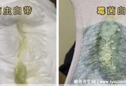 怀孕了有滴虫性阴炎怎么办,怀孕有霉菌影响胎儿吗