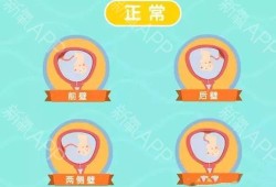 孕期前壁（着床于前壁及后壁啥意思）