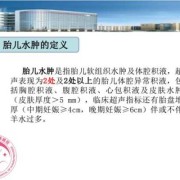 怀孕胎儿水肿有救吗，胎儿水肿如何治疗,胎儿水肿原因分析