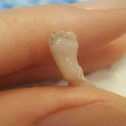 胎儿六个月了（胎儿六个月了还能打掉吗）