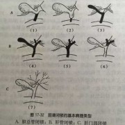 胎儿如何排除胆道闭锁（新生儿胆道闭锁的表现）