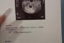 胎儿最迟多久有胎心（胎心多久能查出来）