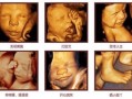 4个月胎儿图片（宝贝四个多月了，缺乏维生素D，要怎么补啊）