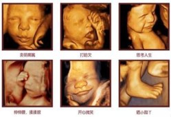 4个月胎儿图片（宝贝四个多月了，缺乏维生素D，要怎么补啊）