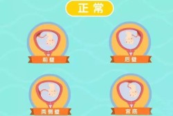 胎儿后壁图（后壁和后位是一个意思吗）