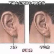 胎儿人中深（人中深浅代表生育力吗）