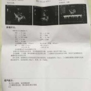 胎儿心脏有问题（胎儿心脏有问题是什么原因造成的）