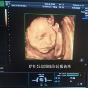 胎儿常规彩超检查什么（宝宝四维彩超是什么）