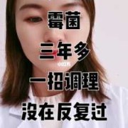 孕期霉菌复发（孕期霉菌复发怎么办）